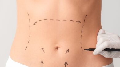 10 Excelentes Clínicas de Cirurgia Plástica em Teresina PI