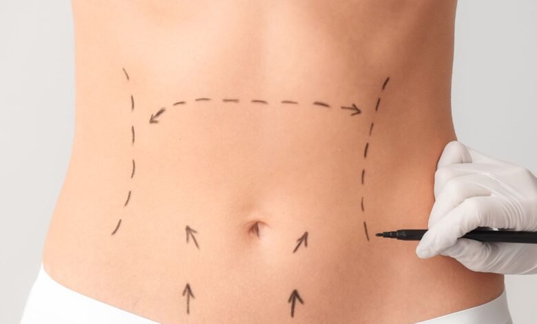 10 Excelentes Clínicas de Cirurgia Plástica em Teresina PI